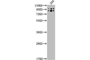 Western Blot Positive WB detected in: 293 whole cell lysate All lanes: BCHE antibody at 1:2000 Secondary Goat polyclonal to rabbit IgG at 1/50000 dilution Predicted band size: 69 kDa Observed band size: 90 kDa (Recombinant Butyrylcholinesterase antibody)
