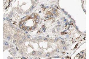 ABIN6279137 at 1/100 staining human kidney tissue sections by IHC-P. (AQP6 antibody  (Internal Region))