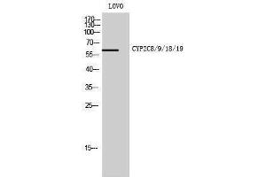 Western Blotting (WB) image for anti-Cytochrome P450, Family 2, Subfamily C, Polypeptide 8/9/18/19 (CYP2C8/9/18/19) (Internal Region) antibody (ABIN3184180) (CYP2C8/9/18/19 antibody  (Internal Region))