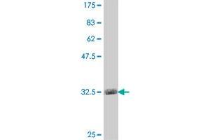 Western Blot detection against Immunogen (34. (PKC beta antibody  (AA 261-341))