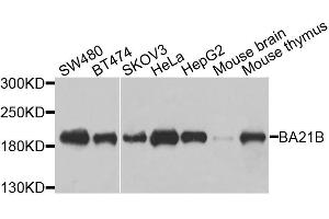 Western blot analysis of extracts of various cell lines, using BAZ1B antibody. (BAZ1B antibody)