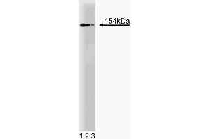 Western blot analysis of RAD50 on a Jurkat cell lysate (Human T-cell leukemia, ATCC TIB-152). (RAD50 antibody  (AA 672-786))