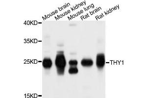 Western blot analysis of extracts of exosome from various cells, using THY1 antibody. (CD90 antibody)