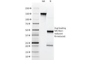SDS-PAGE Analysis Purified NGFR Mouse Monoclonal Antibody (NGFR5).