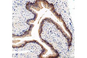 anti-Integrin, alpha 5 (ITGA5) (AA 42-263) antibody