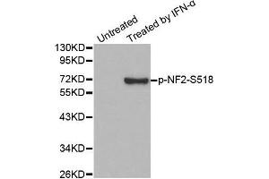 Western blot analysis of extracts from HUVEC cells, using Phospho-NF2-S518 antibody. (Merlin antibody  (pSer518))