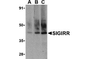 Western Blotting (WB) image for anti-Single Immunoglobulin and Toll-Interleukin 1 Receptor (TIR) Domain (SIGIRR) (C-Term) antibody (ABIN1030659) (SIGIRR antibody  (C-Term))