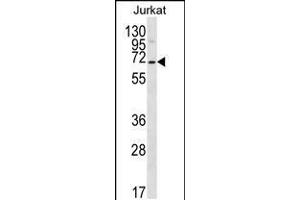 Western blot analysis in Jurkat cell line lysates (35ug/lane). (PSAPL1 antibody  (N-Term))