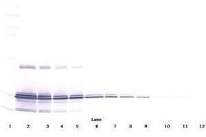Image no. 1 for anti-Interleukin 11 (IL11) antibody (ABIN465144) (IL-11 antibody)