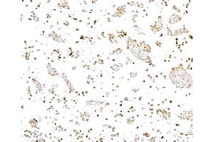 Immunocytochemistry (ICC) image for anti-gamma Histone Variant H2AX (GAMMA-H2AX) (Ser140) antibody (ABIN7454026) (Recombinant gamma H2AX antibody  (Ser140))