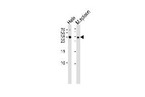 Western blot analysis of lysates from Hela cell line mouse spleen tissue lysate(from left to right), using TCF21 Antibody (C-term) (ABIN655524 and ABIN2845037). (TCF21 antibody  (C-Term))