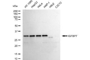 Western blotting analysis using IGFBP7 antibody (ABIN7799056).