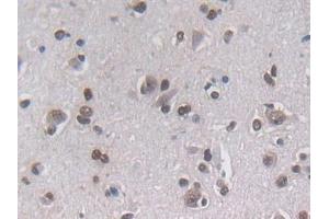 Immunohistochemistry (IHC) image for anti-Phospholamban (PLN) (AA 1-52) antibody (ABIN7442687)