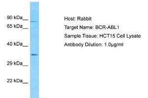 Host: Rabbit Target Name: BCR-ABL1 Sample Type: HCT15 Whole Cell lysates Antibody Dilution: 1. (Oncogene Protein p190/bcr-Abl (N-Term) antibody)