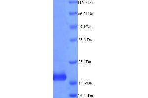 SDS-PAGE (SDS) image for TIMP Metallopeptidase Inhibitor 4 (TIMP4) (AA 30-224) protein (His tag) (ABIN5713896)