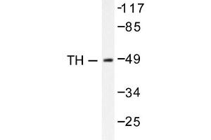 Image no. 1 for anti-Tyrosine Hydroxylase (TH) antibody (ABIN271856) (Tyrosine Hydroxylase antibody)