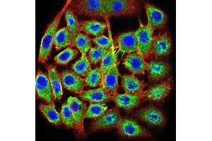 Immunocytochemistry (ICC) image for anti-Transcription Termination Factor, RNA Polymerase I (TTF1) (AA 1-150) antibody (ABIN5871603) (TTF1 antibody  (AA 1-150))