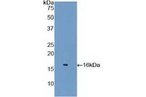 Detection of Recombinant LZM, Mouse using Polyclonal Antibody to Lysozyme (LZM) (LYZ antibody  (AA 22-143))