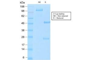 SDS-PAGE analysis of purified, BSA-free recombinant MUC16 antibody (clone OCA125/2349R) as confirmation of integrity and purity. (MUC16 antibody)