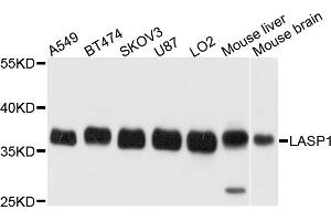 Western blot analysis of extracts of various cell lines, using LASP1 antibody. (LASP1 antibody)