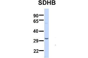 Host:  Rabbit  Target Name:  SERPINA3  Sample Type:  Human Adult Placenta  Antibody Dilution:  1. (SDHB antibody  (Middle Region))