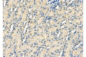 ABIN6262242 and ABIN6278080 at 1/100 staining Mouse kidney tissue by IHC-P. (HIPK2 antibody  (N-Term))