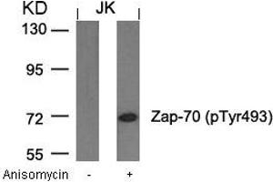 Western blot analysis of extracts from JK cells untreated or treated with anisomycin using Zap-70(Phospho-Tyr493) Antibody. (ZAP7 (pTyr493) antibody)