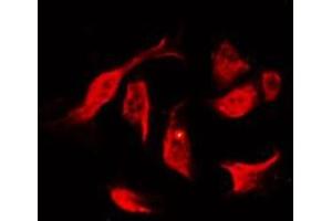 ABIN6267241 staining K562 by IF/ICC. (JAK2 antibody  (pTyr931))