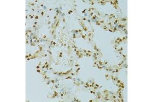 Immunohistochemistry (Paraffin-embedded Sections) (IHC (p)) image for anti-Regulator of Chromosome Condensation 1 (RCC1) (AA 1-240) antibody (ABIN6146817)