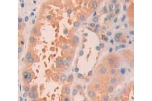 Used in DAB staining on fromalin fixed paraffin- embedded Kidney tissue (HRAS antibody  (AA 82-176))