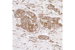 Immunohistochemistry (IHC) image for anti-TNF Receptor-Associated Protein 1 (TRAP1) (AA 600-650) antibody (ABIN7455063)
