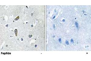 Immunohistochemistry analysis of paraffin-embedded human brain tissue using CDK5RAP2 polyclonal antibody .