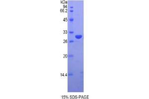 SDS-PAGE analysis of Human VRK1 Protein. (VRK1 Protein)