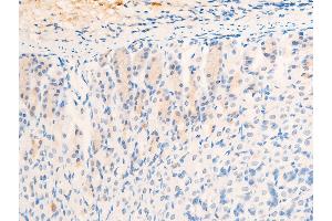 Immunohistochemistry (IHC) image for anti-Epidermal Growth Factor Receptor (EGFR) (pSer1026) antibody (ABIN6254923)