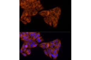 Immunofluorescence analysis of HeLa cells using KIF5B Rabbit mAb (ABIN7268135) at dilution of 1:25 (40x lens).
