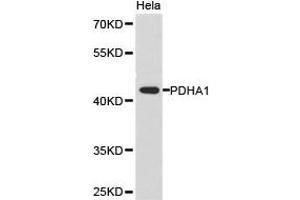 Western Blotting (WB) image for anti-Pyruvate Dehydrogenase (Lipoamide) alpha 1 (PDHA1) antibody (ABIN1874077) (PDHA1 antibody)