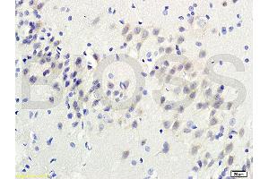 Formalin-fixed and paraffin-embedded : rat brain tissue labeled withRabbit Anti-TGM3 Polyclonal Antibody , Unconjugated, 1:200 followed by conjugation to the secondary antibody