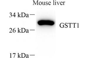 GSTT1 Antikörper