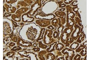 ABIN6279088 at 1/100 staining Human kidney tissue by IHC-P. (ADAMTS17 antibody)