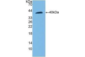 Detection of Recombinant CDH5, Rat using Polyclonal Antibody to Cadherin 5 (CDH5) (Cadherin 5 antibody  (AA 59-382))