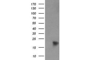 Image no. 8 for anti-NADH Dehydrogenase (Ubiquinone) 1 beta Subcomplex, 9, 22kDa (NDUFB9) (AA 3-179) antibody (ABIN1491360)