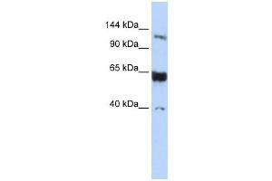 SYCP1 antibody used at 1 ug/ml to detect target protein. (SYCP1 antibody  (N-Term))