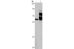 Western Blotting (WB) image for anti-Proprotein Convertase Subtilisin/kexin Type 9 (PCSK9) antibody (ABIN2435166) (PCSK9 antibody)