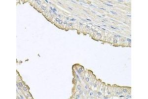 Immunohistochemistry of paraffin-embedded Human prostate using FABP12 Polyclonal Antibody at dilution of 1:100 (40x lens). (FABP12 antibody)