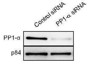WB Image WB to detect PP1 alpha from U2OS cells treated with control siRNA or PP1 alpha siRNA, using  at 1:1000 dilution. (PPP1CA antibody  (Center))