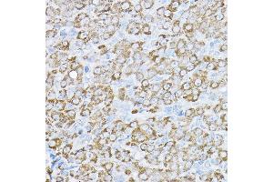 Immunohistochemistry of paraffin-embedded rat ovary using UBE2F Rabbit pAb  at dilution of 1:200 (40x lens). (UBE2F antibody  (AA 1-185))