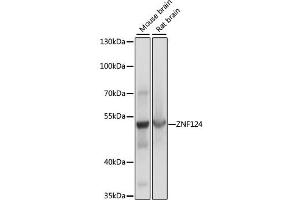 Western blot analysis of extracts of various cell lines, using ZNF124 antibody. (ZNF124 antibody)