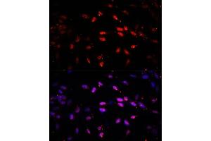 Immunofluorescence analysis of NIH/3T3 cells using KDM6B antibody (ABIN6131823, ABIN6142806, ABIN6142809 and ABIN6216507) at dilution of 1:100. (Kdm6b antibody  (AA 265-450))