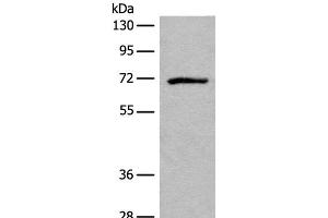 Western blot analysis of Jurkat cell lysate using ADGRE3 Polyclonal Antibody at dilution of 1:550 (EMR3 antibody)