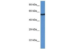 Western Blot showing CAMK2B antibody used at a concentration of 1 ug/ml against THP-1 Cell Lysate (CAMK2B antibody  (Middle Region))
